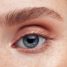 Glaucoma